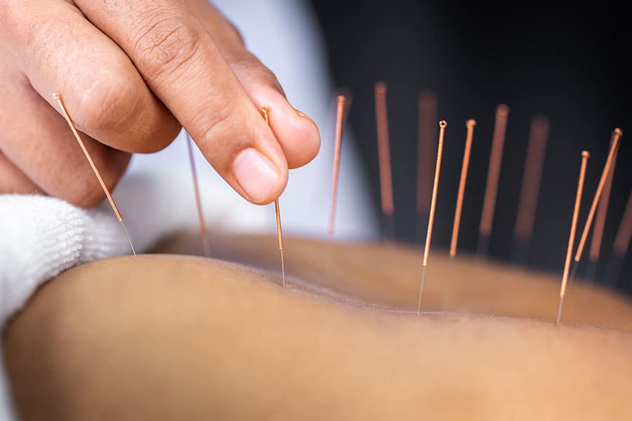 Chinese Massage in Jumeirah Chinese Massage in Jumeirah